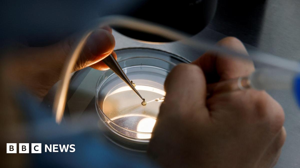 NHS Kent and Medway cuts IVF access and lowers age limit