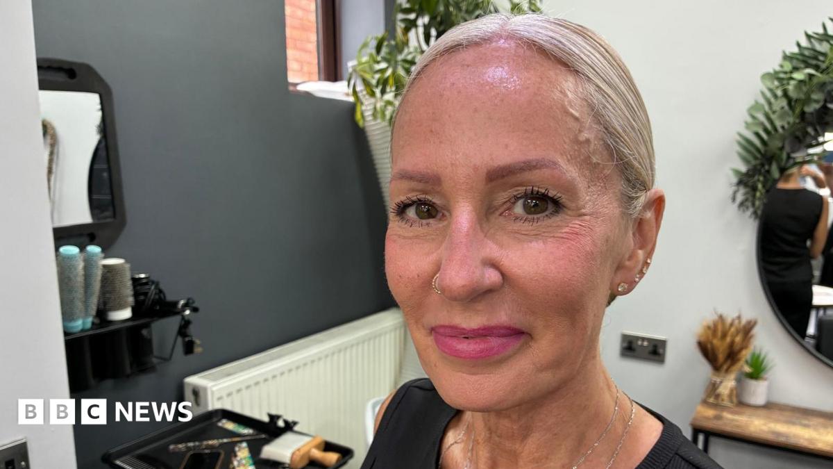 'Bionic' hairdresser's career saved by arthritis study
