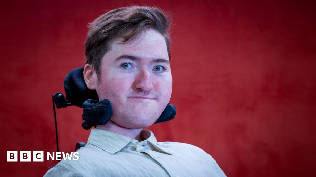 
                            Jesy Nelson spoke about SMA this week - I've lived with it for years