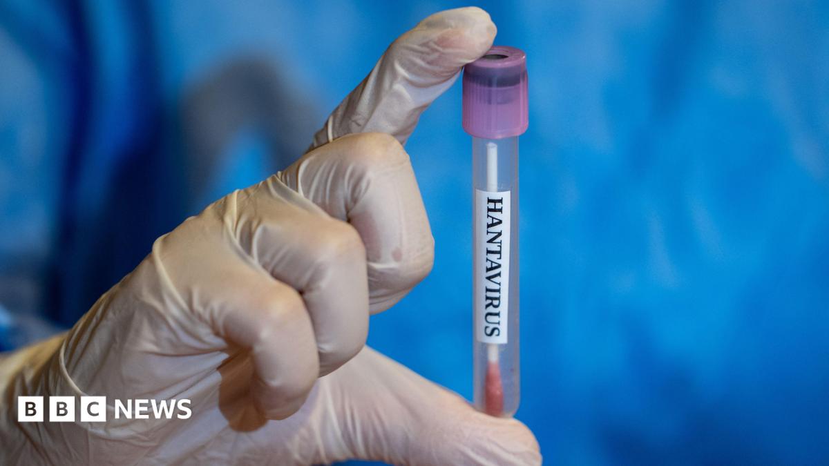 Hantavirus Outbreak Linked to Residents in Wales and Scotland