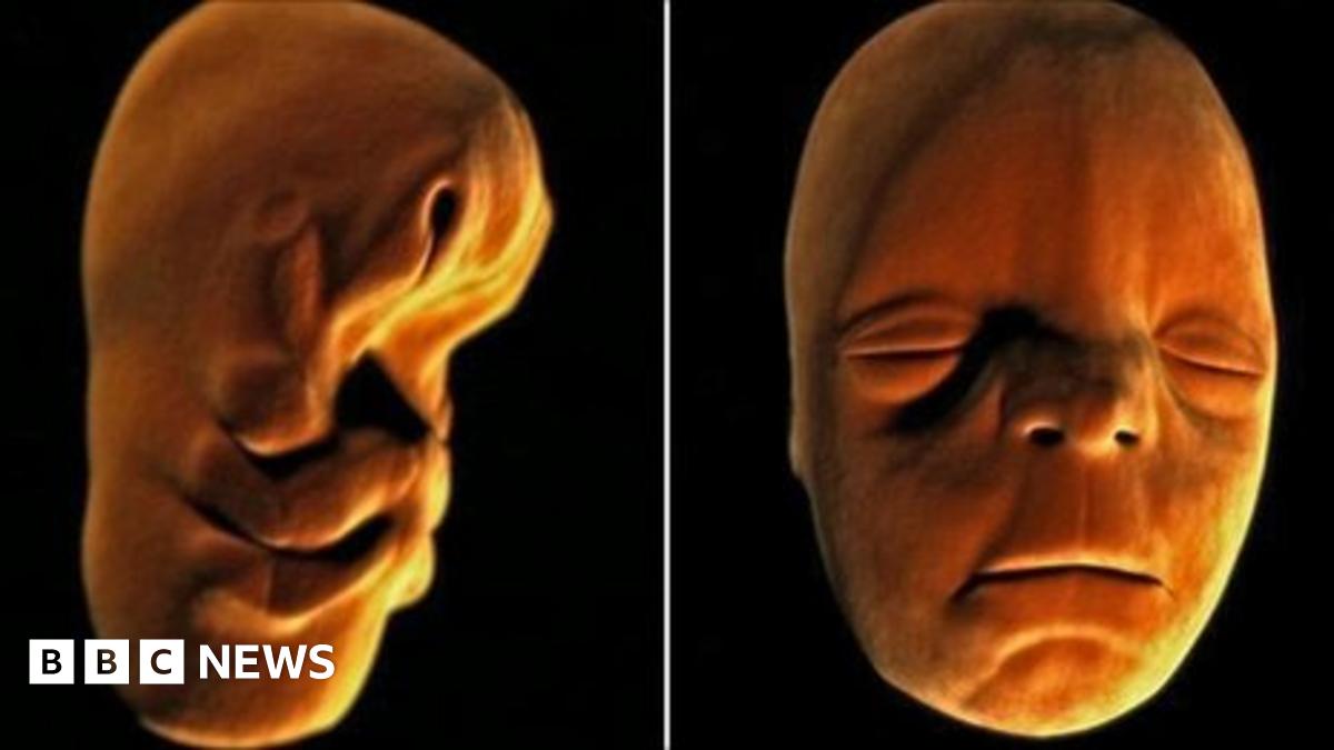 Anatomical clues to human evolution from fish - BBC News