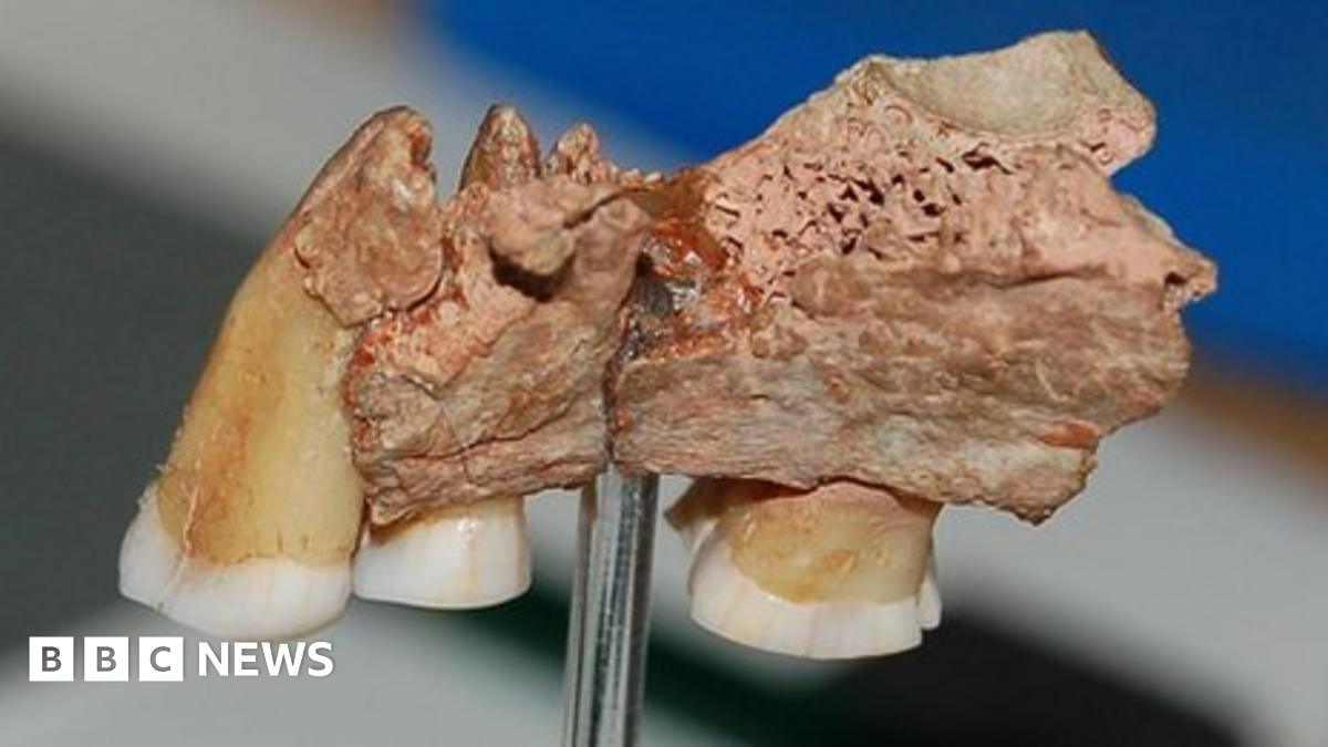 Teeth and jaw are from 'earliest Europeans' - BBC News