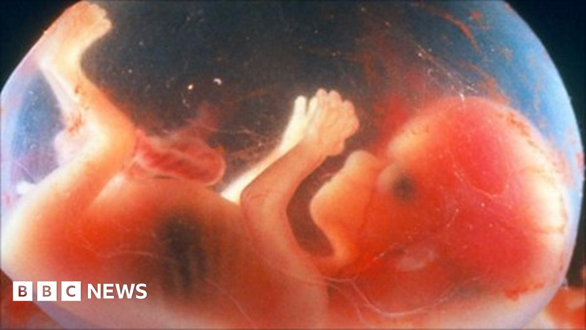 14-week-old foetus