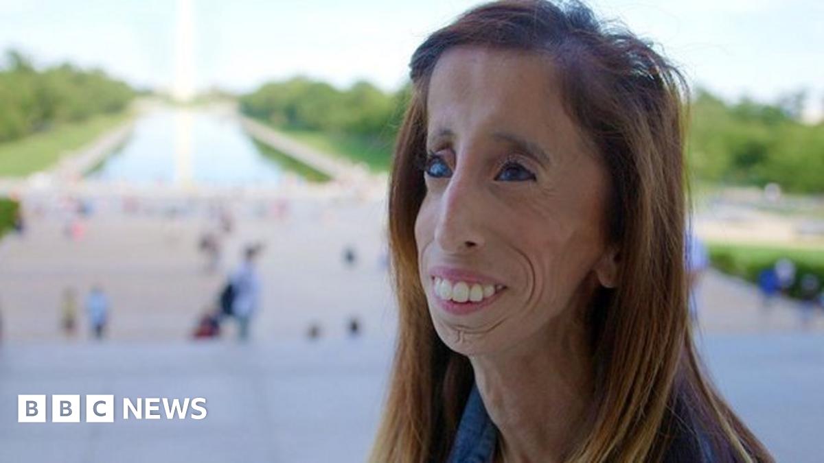 Lizzie Velasquez Online Bullies Called Me The World S Ugliest Woman Bbc News