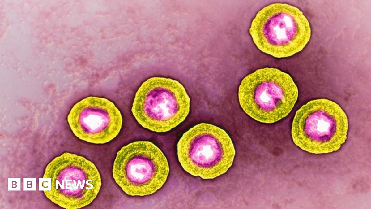 Cold sore virus 'treats skin cancer' - BBC News