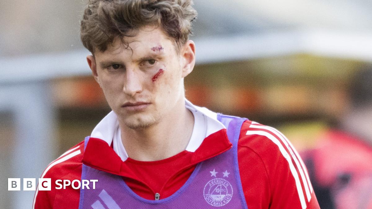 Police search for fan who threw seat that injured MacKenzie