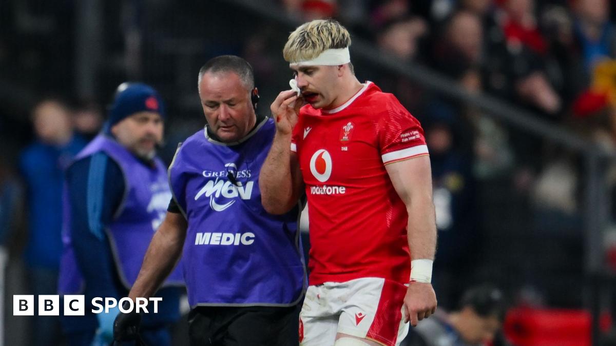 Six Nations: Wales wait on Aaron Wainwright fitness before Italy test