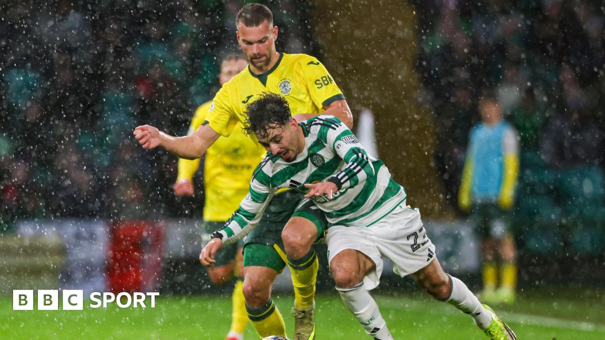 O'Neill Understands Hibs Fans' Dilemma but Expects No Impact on Celtic Clash — image 1