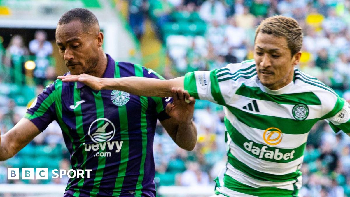 Celtic Hosts Hibs With Key Returns, Historic Unbeaten Run at Stake