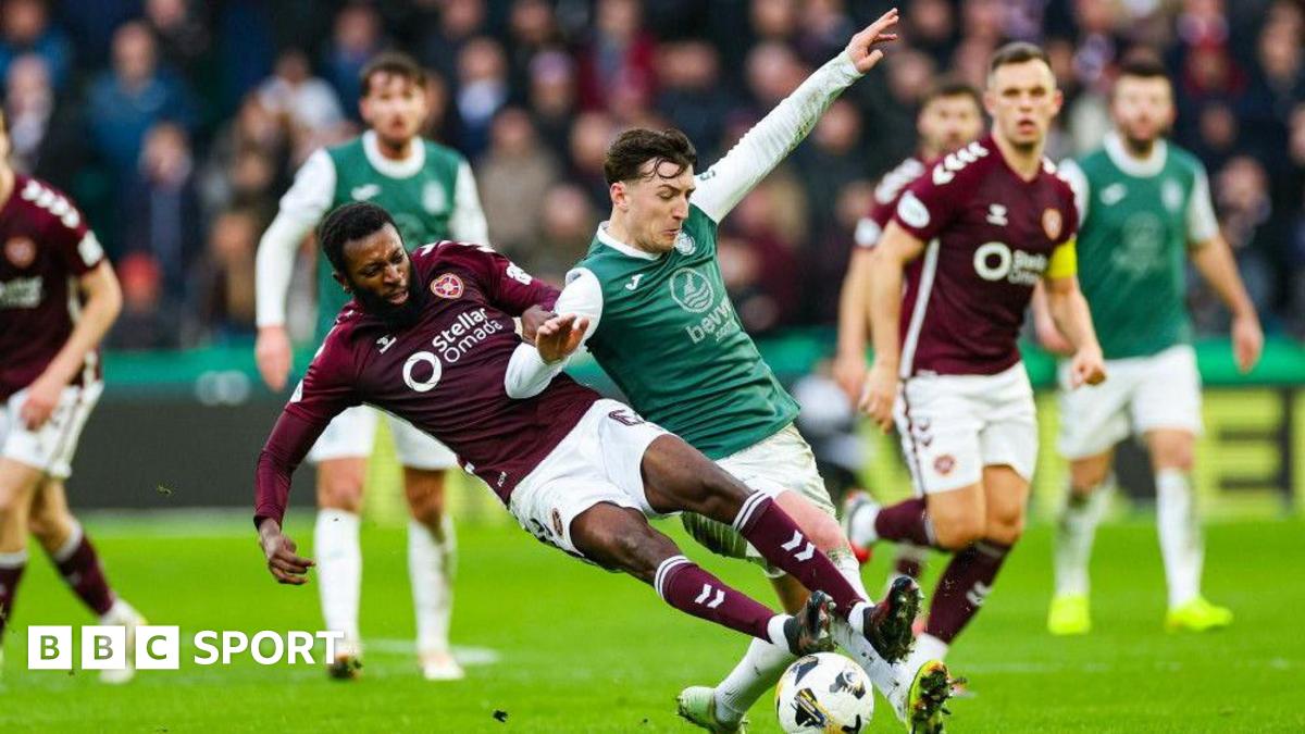 Tekanan dari kedua belah pihak sangat besar dalam derbi Edinburgh