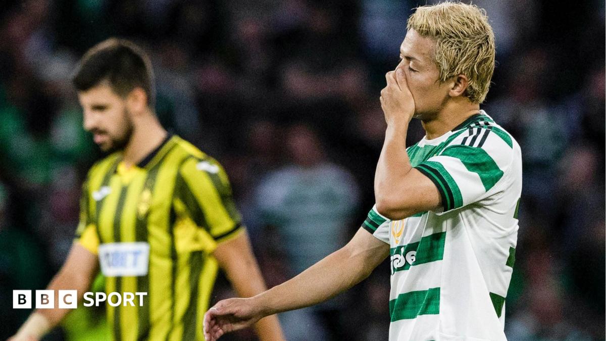 What did the pundits say about Celtic's draw with Kairat?