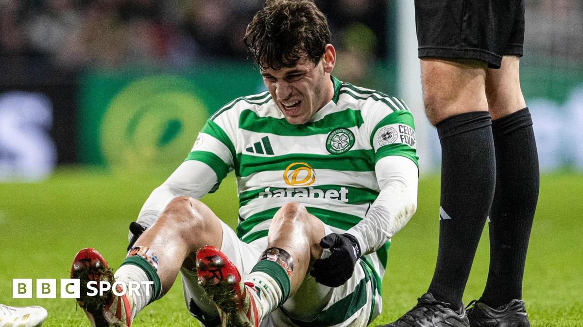 Celtic's Bernardo out for five weeks but Forrest in training