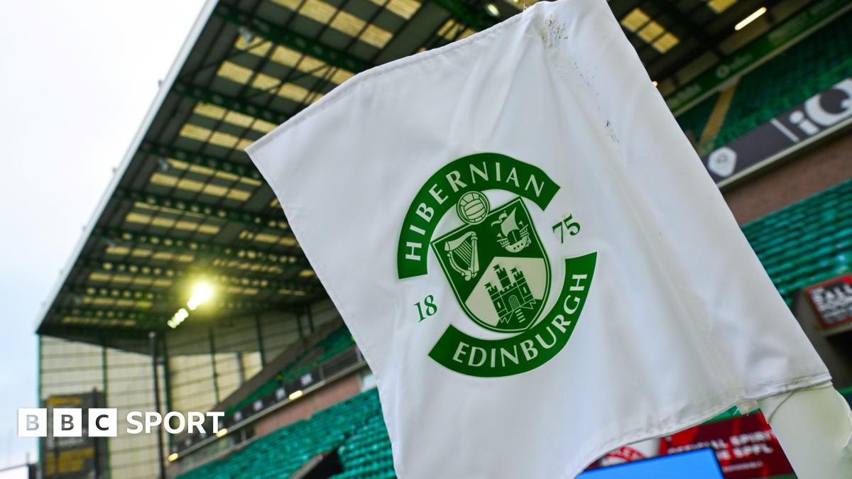 Hibs lose £7.2m despite investment and income from Europe