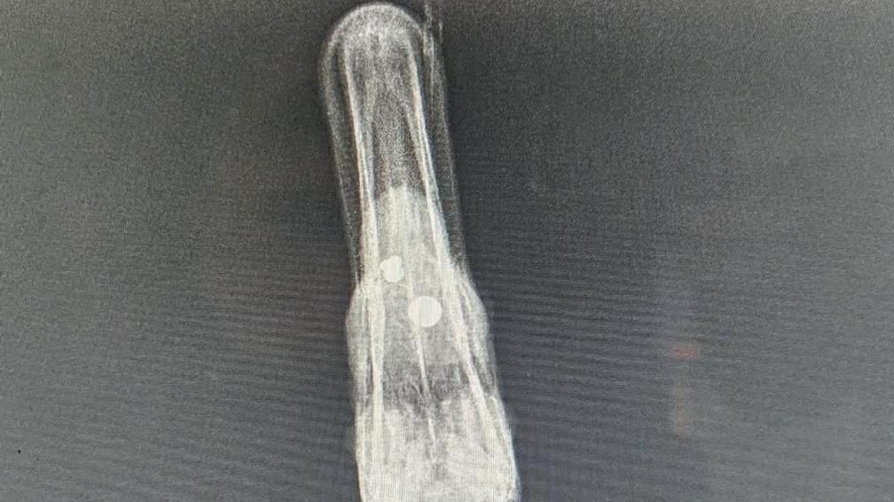 Black and white image of an X-ray showing circular ball bearings lodged in the beak of a swan.