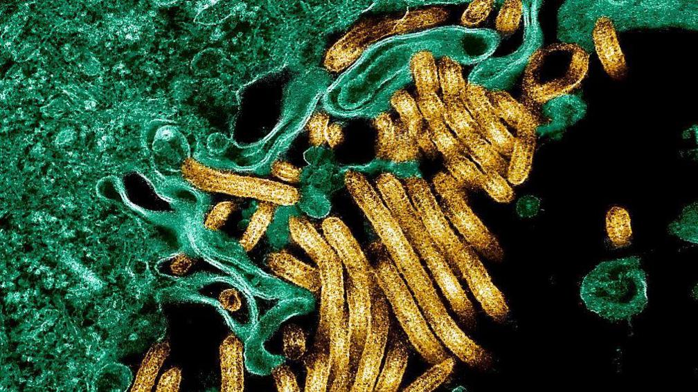 Colorised transmission electron micrograph of Ebola virus particles (in gold) with other cells in green