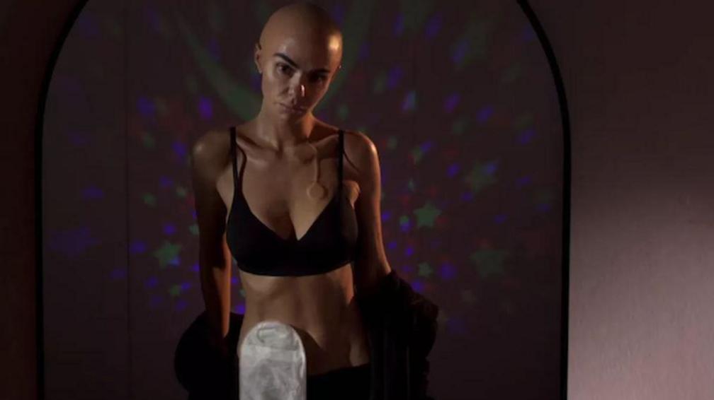 Hollyoaks character Mercedes McQueen played by actress Jennifer Metcalfe is seen without any hair, with a chemotherapy port on her chest and a stoma bag attached to her stomach 