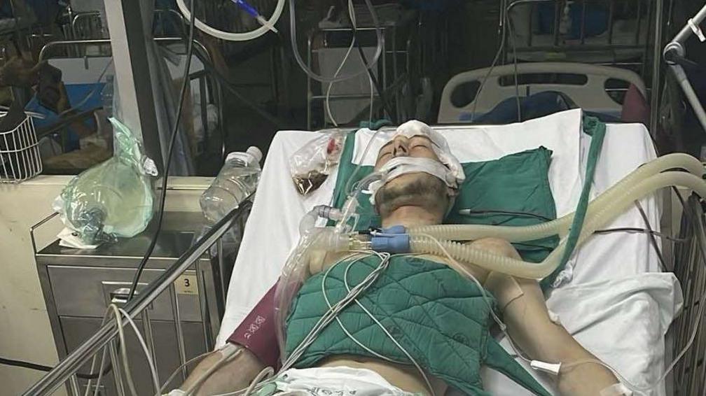 A man in a hospital bed in Thailand. There are tubes across his chest and in his mouth.