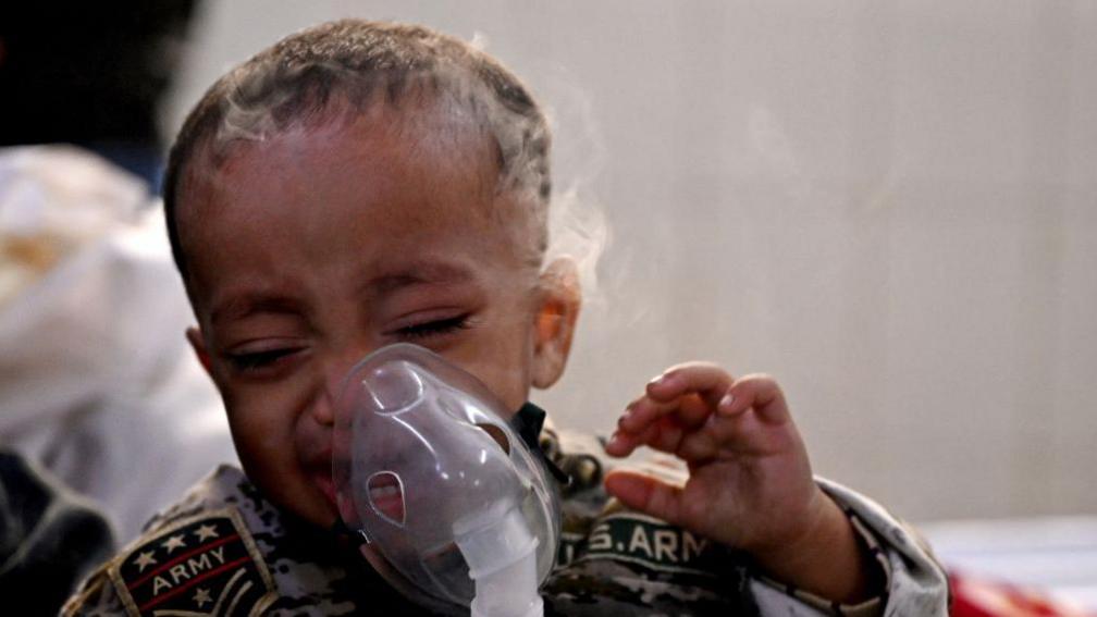 In this picture taken in 2023, a boy with breathing difficulties breathes with the help of a nebuliser at the emergency ward of a government-run children hospital in New Delhi.
