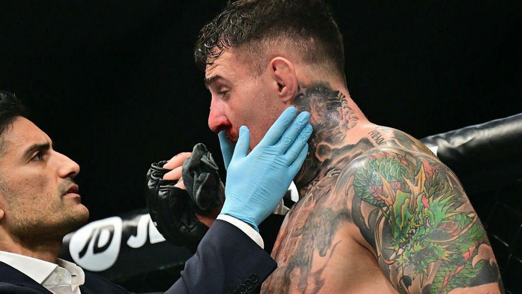 A doctor checks on Tom Aspinall's eye after an eye poke