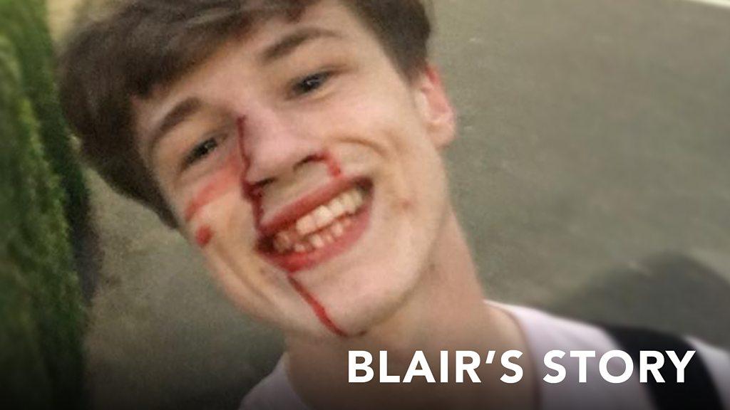 The way Blair reacted to being attacked is unbelievable.