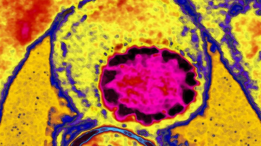 A CAT scan image made up of vibrant abstract shapes and colours. At the heart of the image is a large, circular shape that glows with a deep, electric pink. It’s surrounded by a dark, almost black border, giving it the appearance of a nucleus or a central core. Radiating outward from the centre are patches of fiery red and golden yellow. Thin purple and bright blue lines trace the edges of some regions, resembling membranes or boundaries.