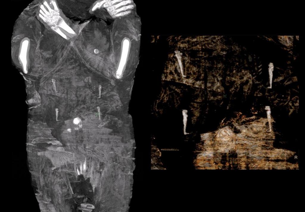 Mummy-shaped amulets are seen on scan inside the body of mummy