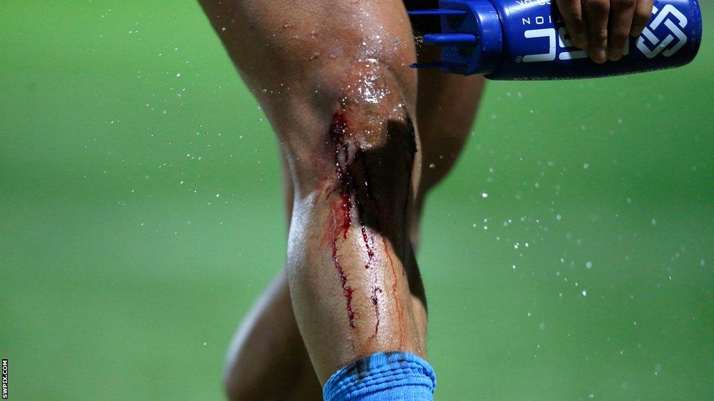 Jorge Taufua's bleeding knee