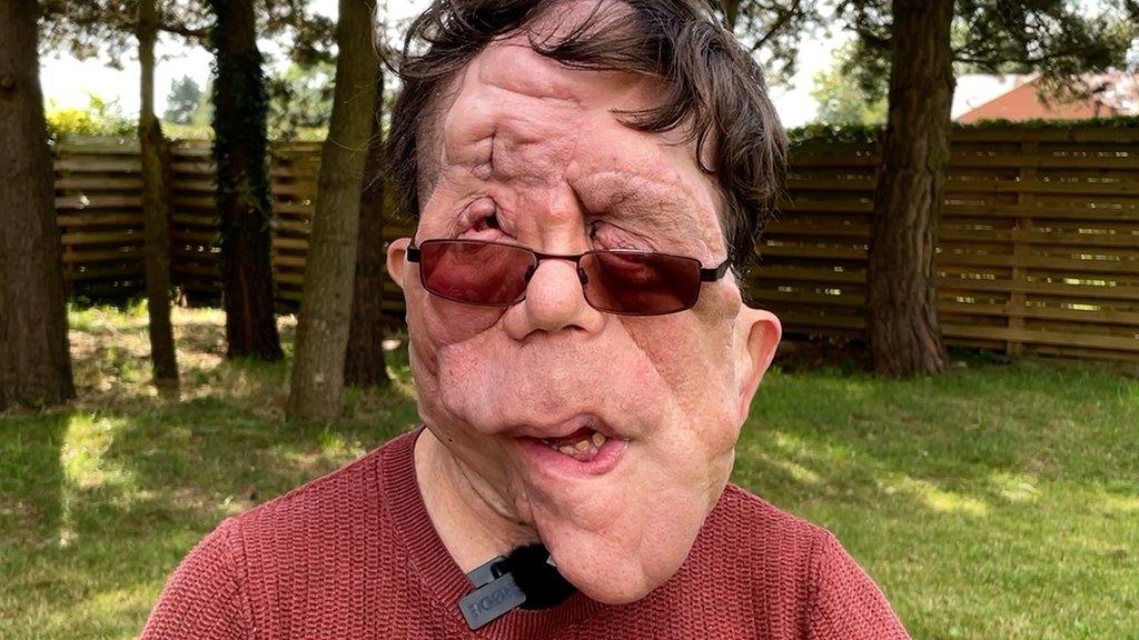 Adam Pearson