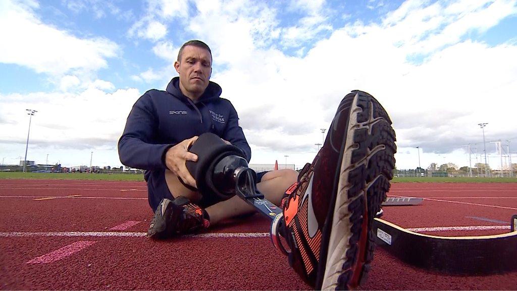 A man fitting his prosthetic leg