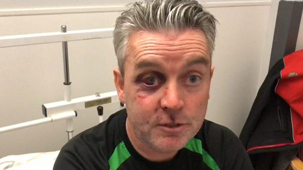 Referee sustains serious facial injuries