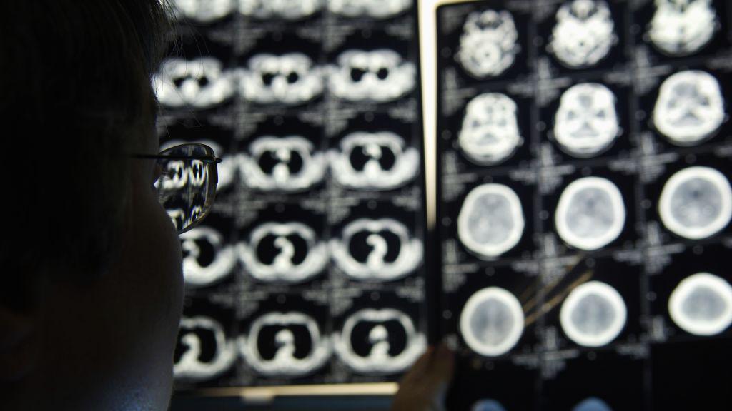 Stock image of a radiologist, wearing glasses, examining various CT scans on a screen