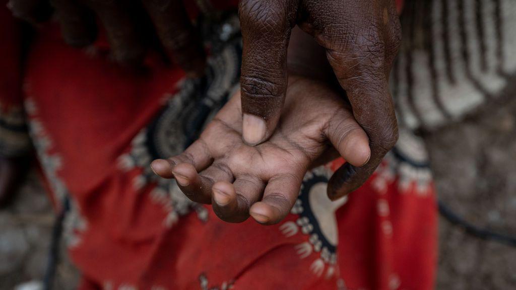 A child's hand is face up with the thumb of an older person's hand pressing into it. A red cloth is out of focus behind the hands.