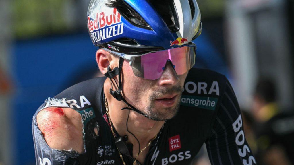 An image of Primoz Roglic with a bloodied shoulder and a ripped jersey after his stage 12 crash 