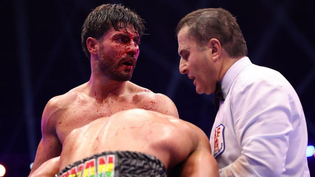 Josh Kelly has blood on his face