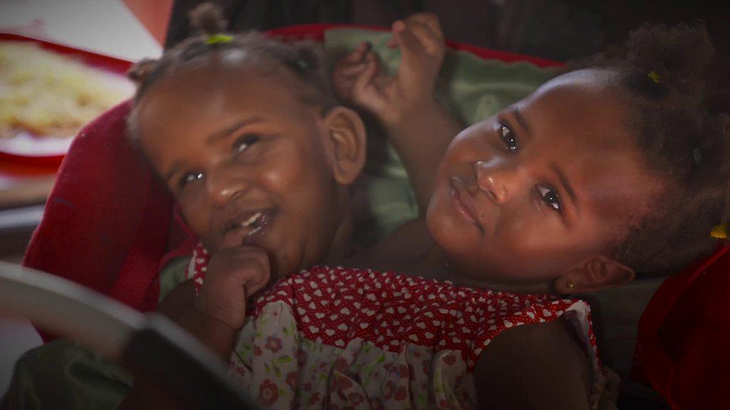 Conjoined twins Marieme and Ndeye