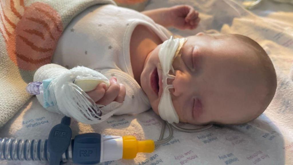 Close up of a three week old baby lying on a blanket in hospital with medical rubes up her nose. She has her eyes closed and her arms up by her side 