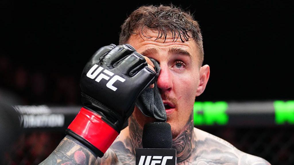 Tom Aspinall holds a cloth to his eye and speaks into a microphone