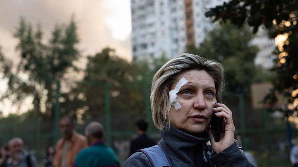  An injured woman watches while speaking on the phone. 