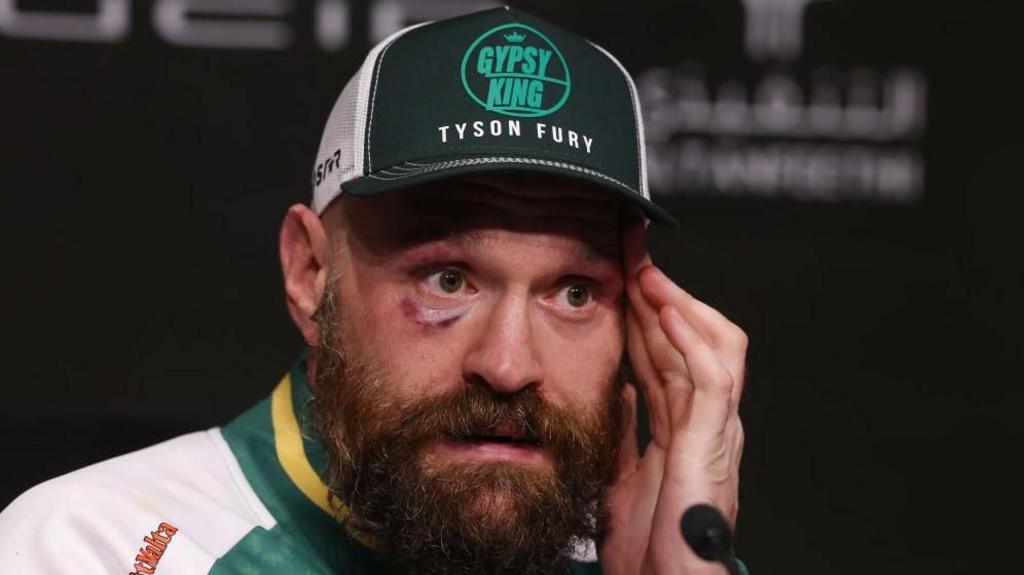 Fury will never fight again – Arum