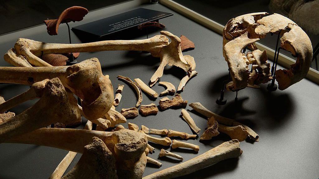 Parts of a skeleton in a display case, some of its skull is missing as well as several ribcage parts.
