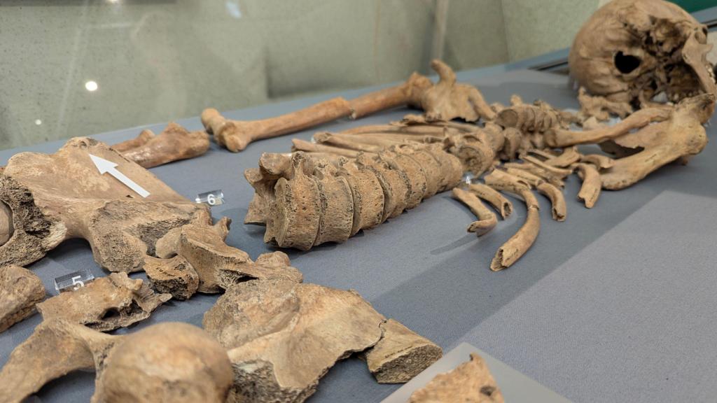 Bites on gladiator bones prove combat with lion