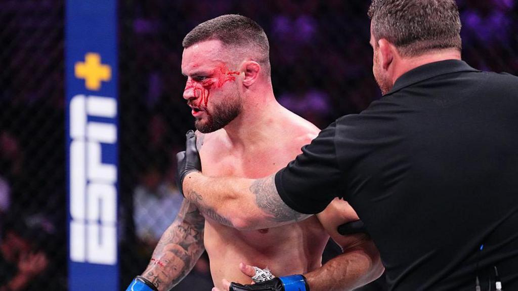 Marc Goddard holds onto a bloodied Kiefer Crosbie