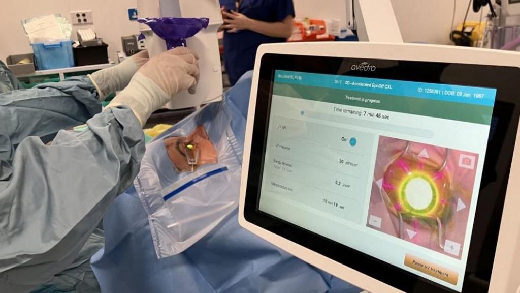 A cross-linking procedure taking place to treat corneal ectasia. A woman lies on a hospital bed and has her eye clamped open to allow a surgeon to add the drops into her eye. In the forefront of the picture is a screen that shows the eye very close up. 