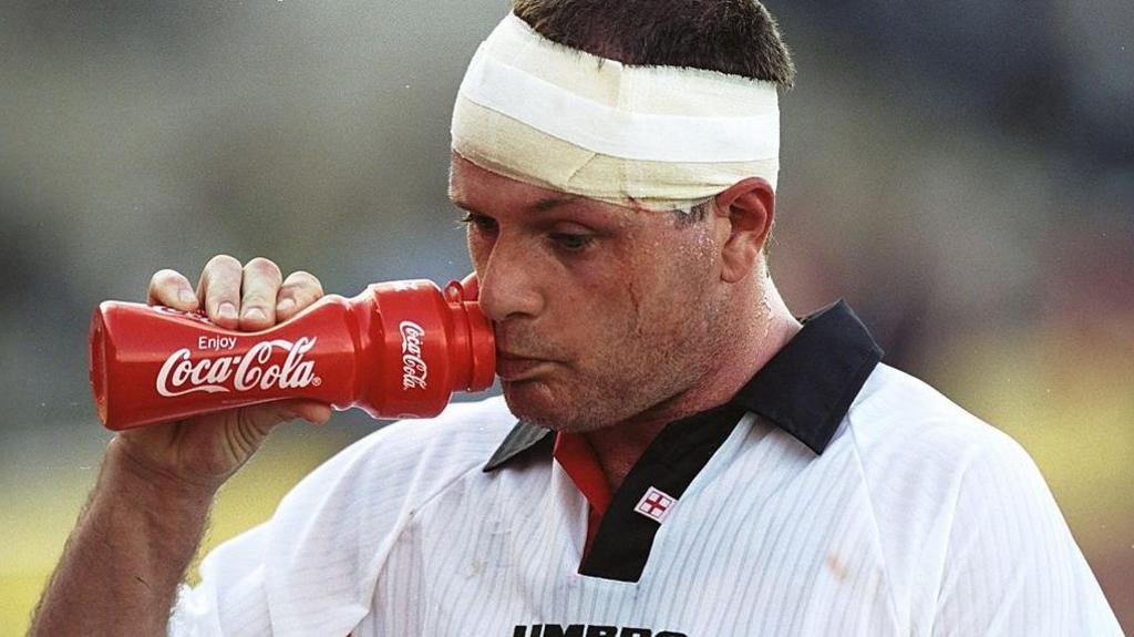 Paul Gascoigne with his head bandaged, wearing an England shirt and drinking from a water bottle