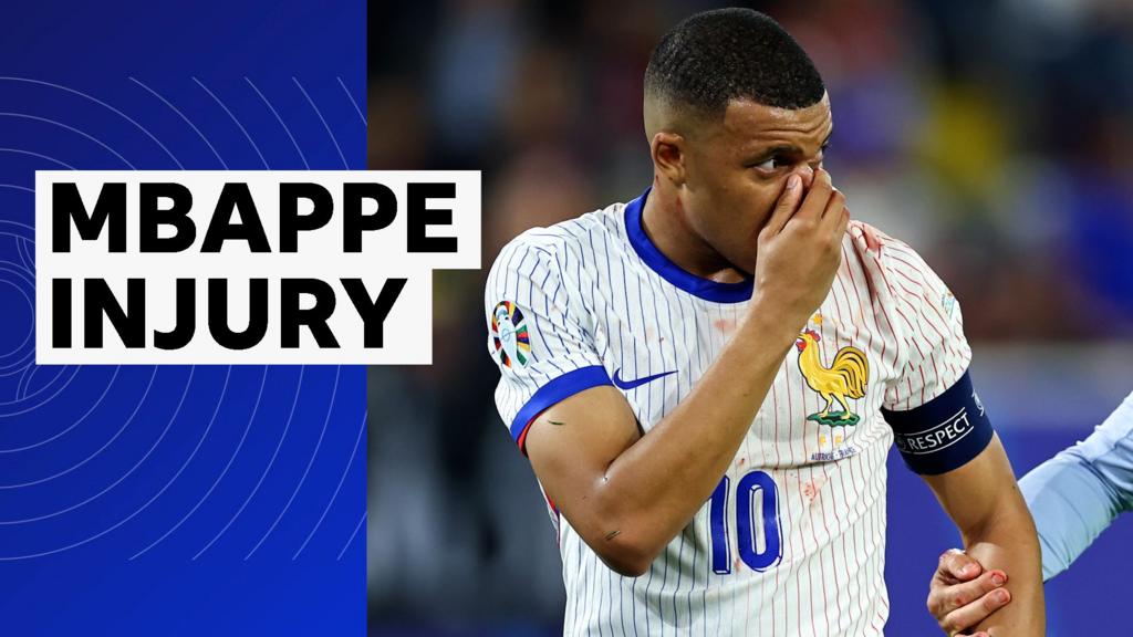 Mbappe booked after suffering nasty facial injury