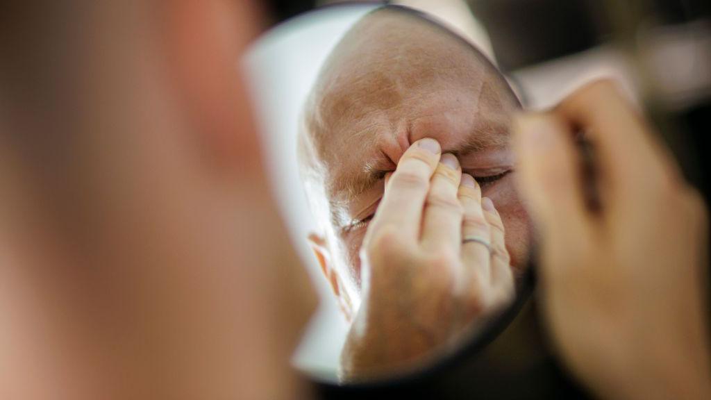 A man rubs his aching head with his hand