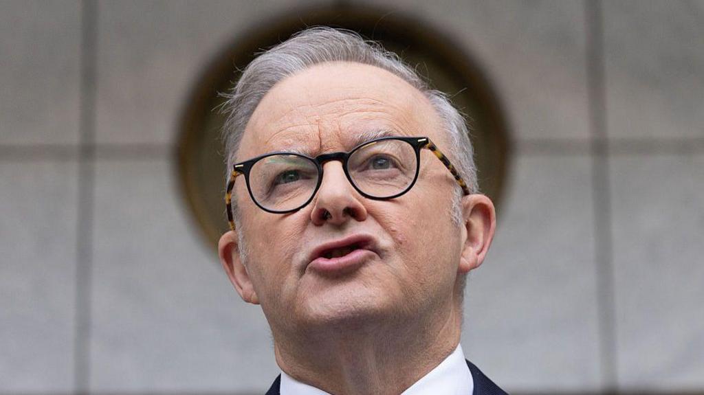 Anthony Albanese