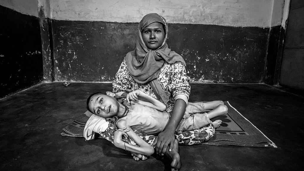 BHOPAL, INDIA: Sameer Hasan, 16 years old, with his mother Wahida Bee at home. Sameer was born to parents contaminated by a carcinogenic and mutagenic water supply. This year marks the 31st anniversary of the 1984 Union Carbide gas tragedy that killed thousands of citizens of Bhopal within 72 hours and has gone on to claim thousands more as a result of the polluted environment. (Photo by Giles Clarke/Getty Images)