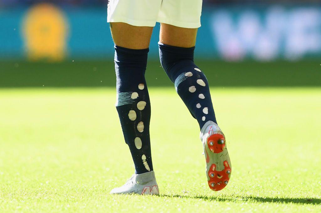 Kyle Walker's socks with holes in 