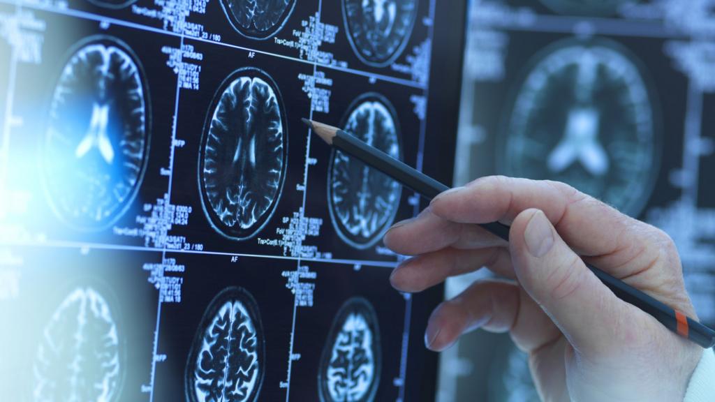 A person holds a pencil in their hand in front of brain scans